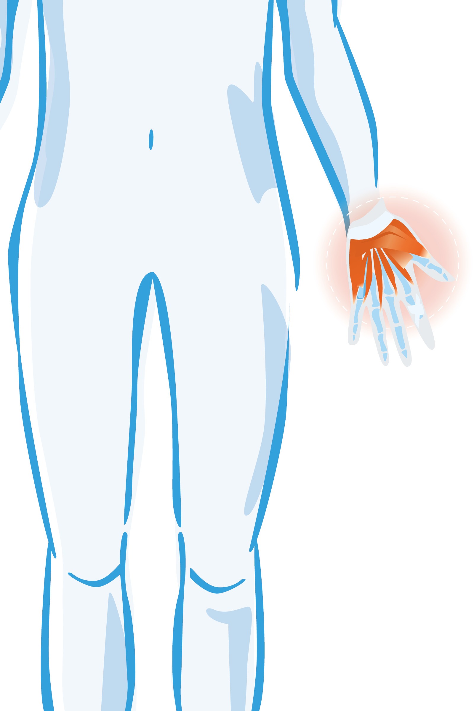 Pols- en handklachten