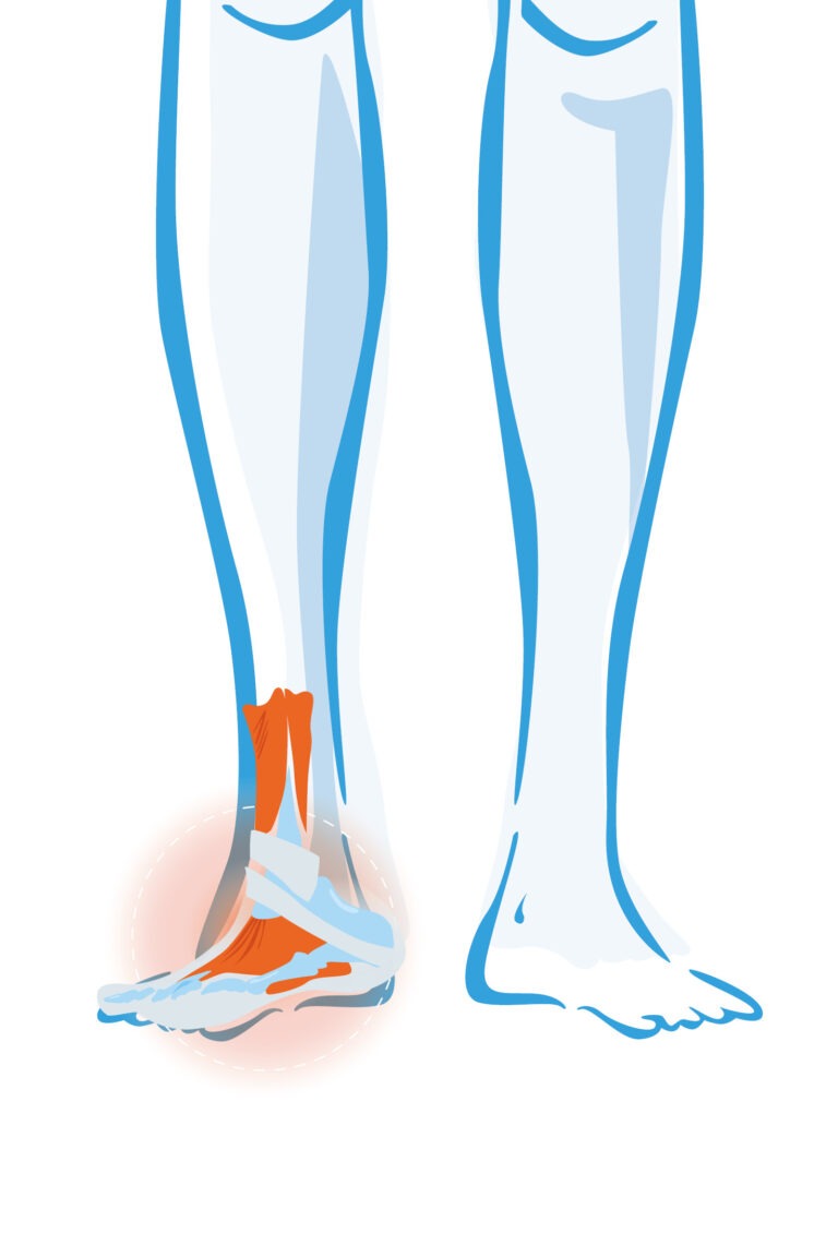 Enkel- en voetklachten